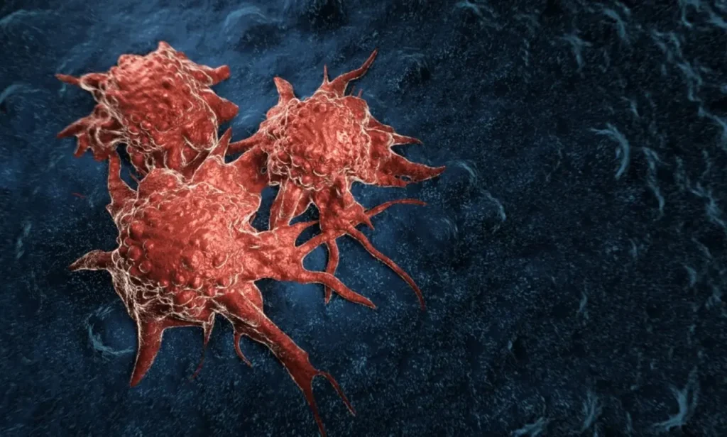 Microplásticos en el pulmón: un estudio en Grecia los detecta con más frecuencia en pacientes con cáncer
